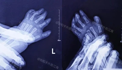 info-1080-622 info-1080-622