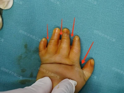 info-1080-810 info-1080-810